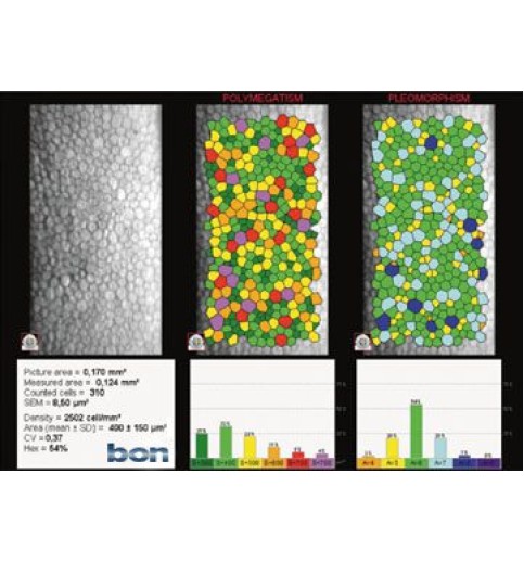 Bon Perseus Specular Microscope