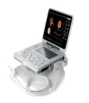 Esaote Mylab Alpha Portable Ultrasound