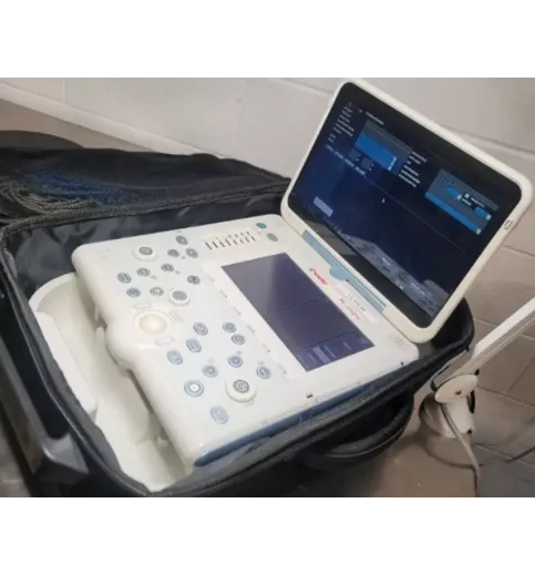 Esaote Mylab Alpha Portable Ultrasound