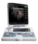 Esaote Mylab Gamma Multipurpose Portable Ultrasound
