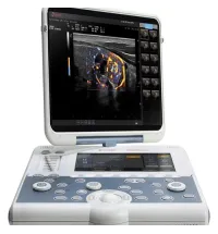 Esaote Mylab Gamma Multipurpose Portable Ultrasound