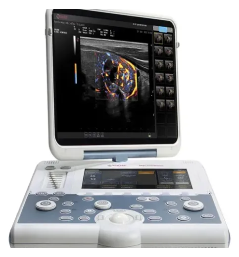 Esaote Mylab Gamma Multipurpose Portable Ultrasound
