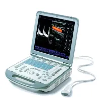 Mindray M5 Portable Ultrasound