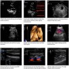 Mindray M7 Portable Ultrasound