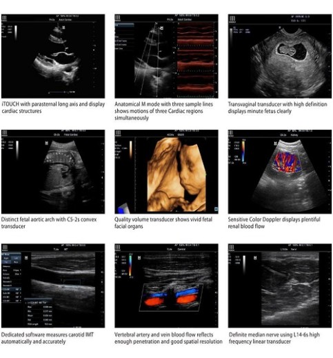 Mindray M7 Portable Ultrasound