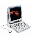 Mindray Z6 Portable Colour Doppler Ultrasound