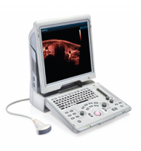 Mindray Z6 Portable Colour Doppler Ultrasound