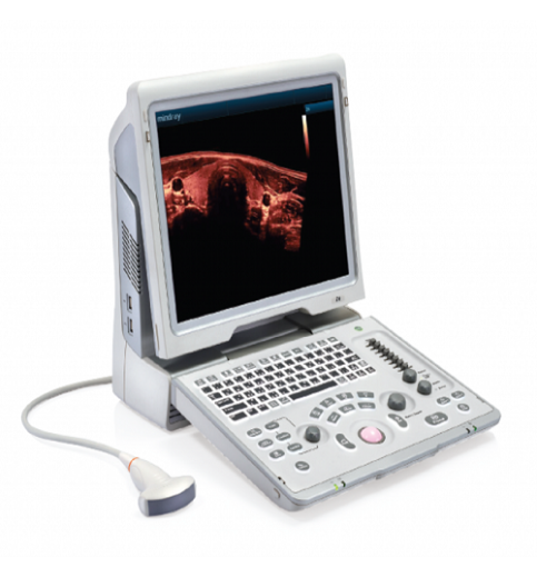 Mindray Z6 Portable Colour Doppler Ultrasound