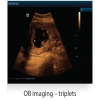 Mindray Z6 Portable Colour Doppler Ultrasound