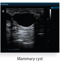 Mindray Z6 Portable Colour Doppler Ultrasound