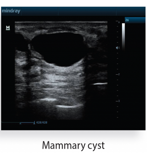 Mindray Z6 Portable Colour Doppler Ultrasound