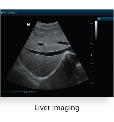Mindray Z6 Portable Colour Doppler Ultrasound
