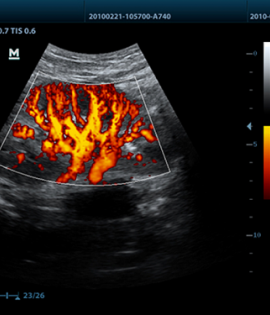 Mindray Z6 Portable Colour Doppler Ultrasound Mindray Z6 Portable Colour Doppler Ultrasound