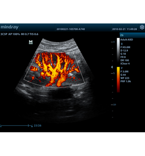 Mindray Z6 Portable Colour Doppler Ultrasound
