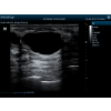 Mindray Z6 Portable Colour Doppler Ultrasound