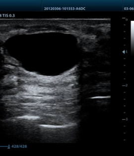Mindray Z6 Portable Colour Doppler Ultrasound Mindray Z6 Portable Colour Doppler Ultrasound