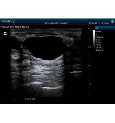 Mindray Z6 Portable Colour Doppler Ultrasound