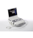 Siemens Acuson P300 Ultrasound