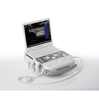 Siemens Acuson P300 Ultrasound