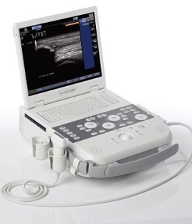 Siemens Acuson P300 Ultrasound Siemens Acuson P300 Ultrasound