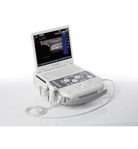 Siemens Acuson P300 Ultrasound Siemens Acuson P300 Ultrasound