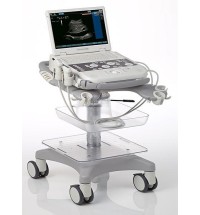 Siemens Acuson P300 Ultrasound