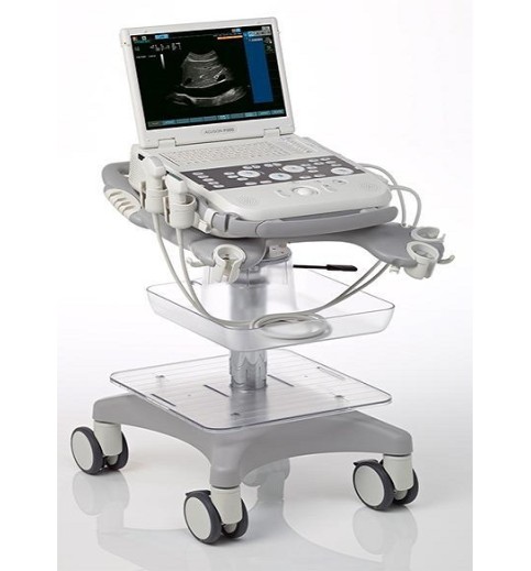 Siemens Acuson P300 Ultrasound Siemens Acuson P300 Ultrasound