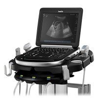 Sonosite Edge Portable Ultrasound
