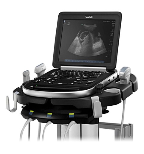 Sonosite Edge Portable Ultrasound