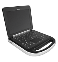 Sonosite Edge Portable Ultrasound