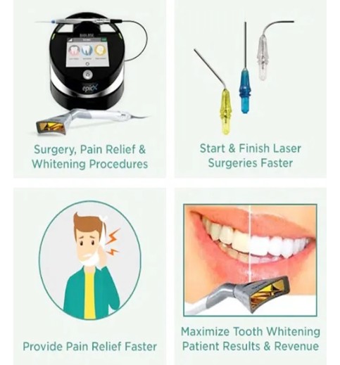 Biolase Epic X Dental Diode Laser Biolase Epic X Dental Diode Laser